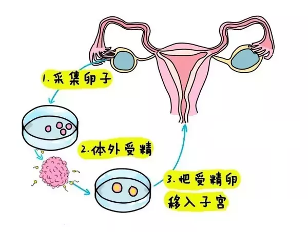 泰国试管婴儿