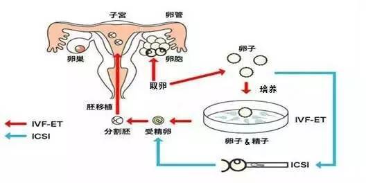 青岛市试管婴儿价格